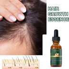 Ginger Hair Growth Essence 30ML Pack of 1
