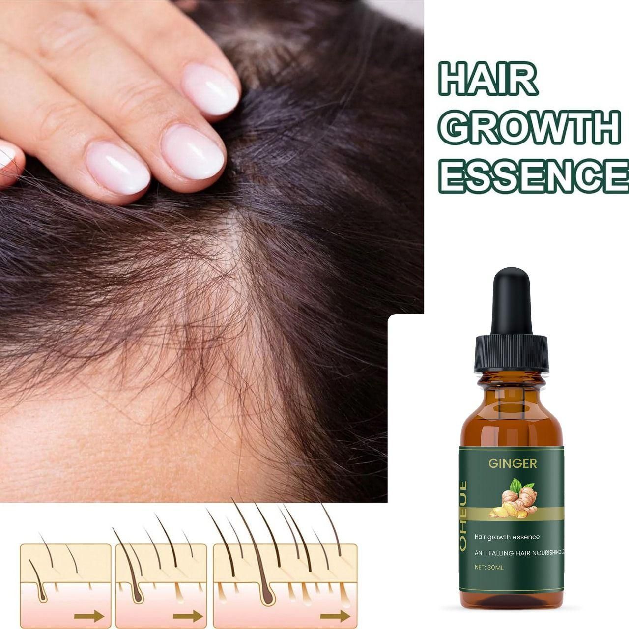 Ginger Hair Growth Essence 30ML Pack of 1