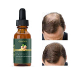 Ginger Hair Growth Essence 30ML Pack of 1